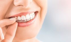 Çocuk Ortodonti Tedavisine Kaç Yaşında Başlanmalı?