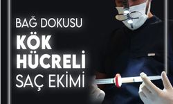 Murat Makascı : Kök Hücre ile Saç Ekimi Nasıl Yapılır ?