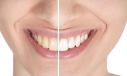 Samsun En İyi Diş Hekimi Merkezi Harbalıoğlu Ağız & Diş Sağlığı: Sağlığınız Bizim Önceliğimiz!