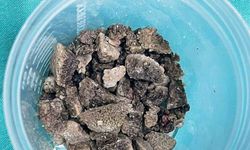 8 santimetrelik ’geyik boynuzu’ kapalı yöntemle çıkarıldı