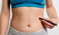 Doğum Sonrası Karın Toplamada En Etkili Yöntem: Karın Germe Ameliyatı