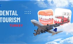 Uygun Fiyatlı İmplant Tedavisi İçin Türkiye Neden Tercih Ediliyor?