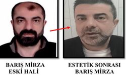 Ameliyat ile yüzünü değiştirdi; Adaletten kaçamadı