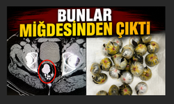 Midesinden uyuşturucu madde çıkan şahıs tutuklandı