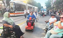 Ayağımın kesilmesinden çok insanların tavrı üzdü