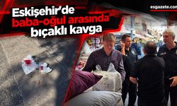 Eskişehir'de baba-oğul arasında bıçaklı kavga