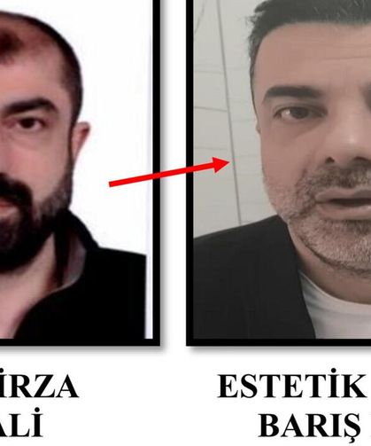 Ameliyat ile yüzünü değiştirdi; Adaletten kaçamadı