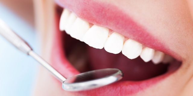 Ortodonti Tedavisi Nedir, Nasıl Yapılır?