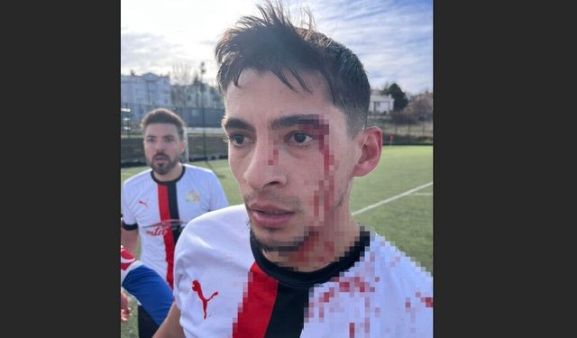 Maç sonrası saha içi savaş alanına döndü