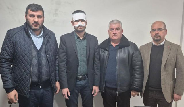 Müdür Yardımcısının Yüzüne Sıcak Çay Fırlatıldı