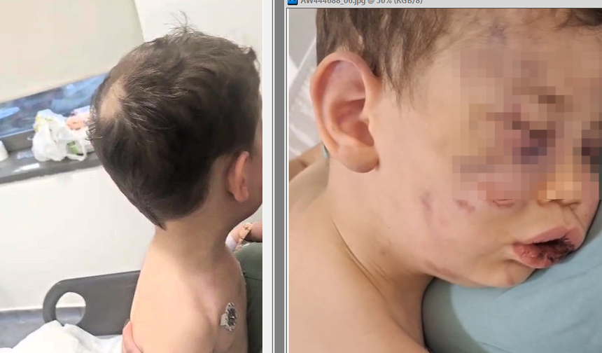 Vahşeti yaşayan 2 yaşındaki bebek hastanelik oldu