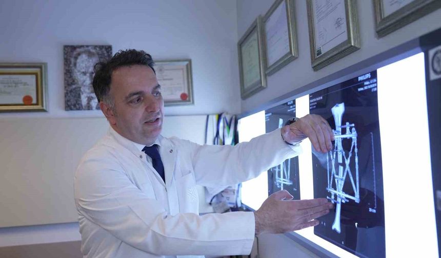 Boy kısalığına karşı modern çözüm: kemik uzatma yöntemleri