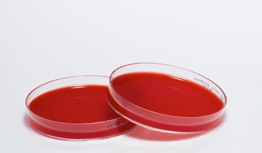 Mikrobiyolojide Güvenilir Çözümler: Medexia ve Besiyeri Üretimi