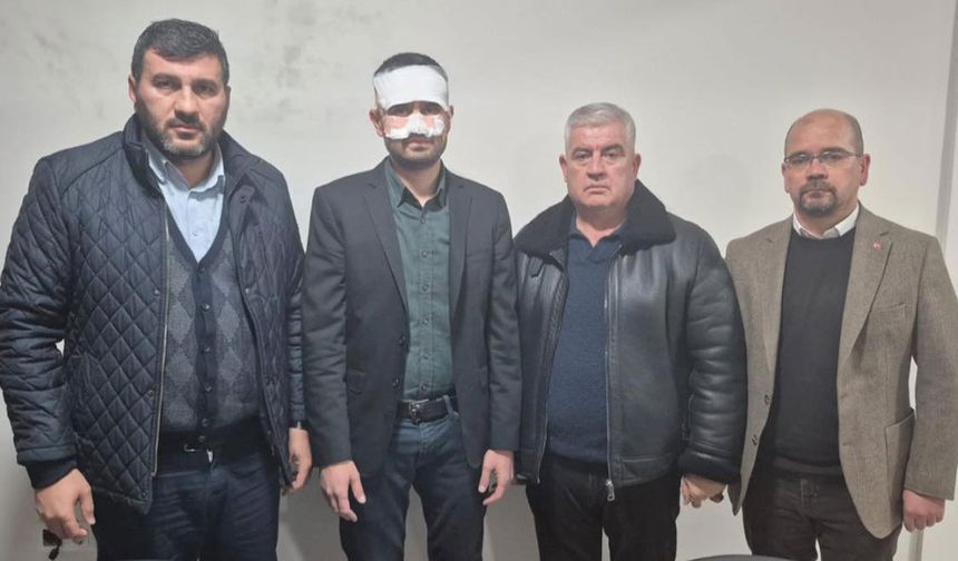 Müdür Yardımcısının Yüzüne Sıcak Çay Fırlatıldı