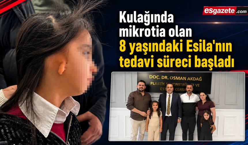 Kulağında mikrotia olan 8 yaşındaki Esila'nın tedavi süreci başladı