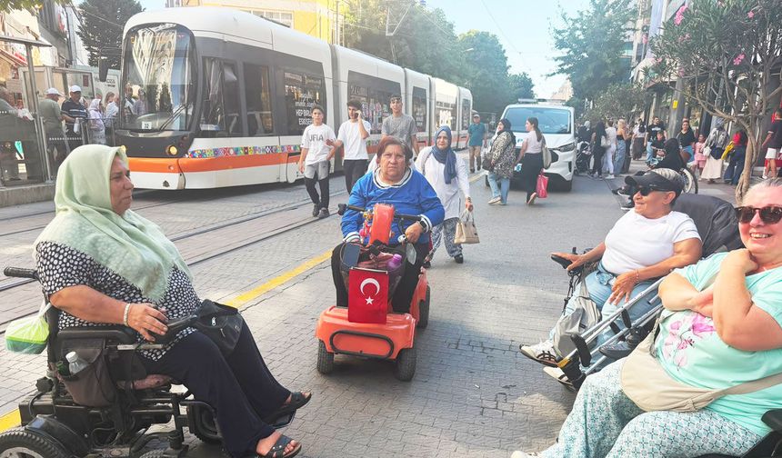 Ayağımın kesilmesinden çok insanların tavrı üzdü